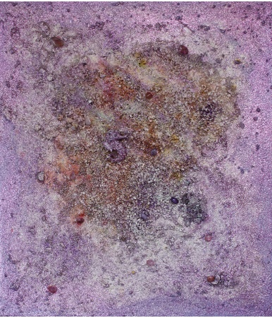 hippocampus